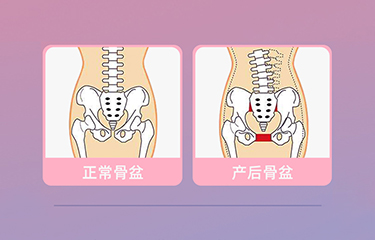 盆底肌修復儀器怎么樣？哪些人可以使用它呢