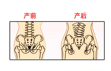 月子期間盆骨儀器修復時間有限制嗎？與手法修復相比哪個效果好？